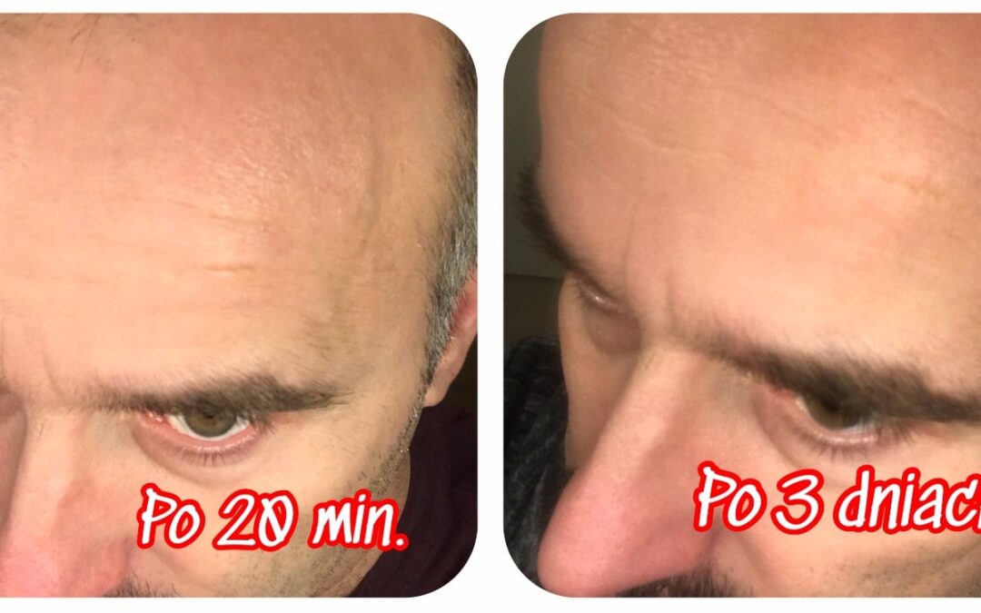 Odmłodzenie w 20 minut – test maski Larens Bio Renew na mężczyźnie