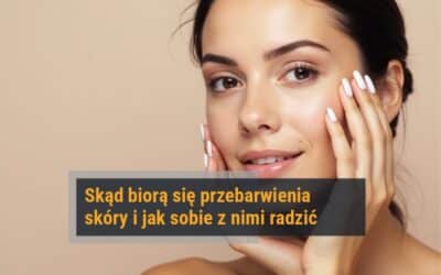 Skąd biorą się przebarwienia skóry i jak sobie z nimi radzić