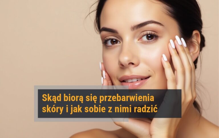 Webinar o przebarwieniach